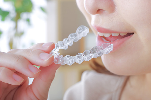 マウスピース矯正